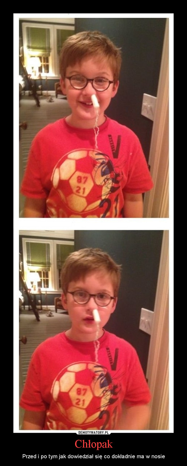 Chłopak – Przed i po tym jak dowiedział się co dokładnie ma w nosie 