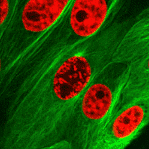Tak wygląda podział komórki do którego dochodzi w organizmie ludzkim –  