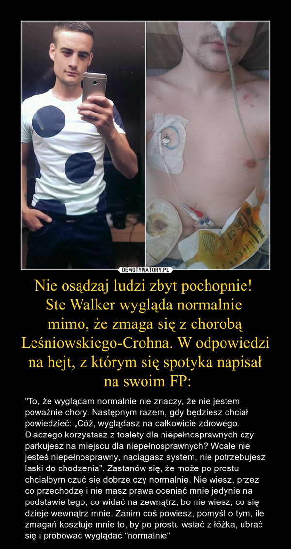 Nie osądzaj ludzi zbyt pochopnie! 
Ste Walker wygląda normalnie 
mimo, że zmaga się z chorobą Leśniowskiego-Crohna. W odpowiedzi na hejt, z którym się spotyka napisał
 na swoim FP: