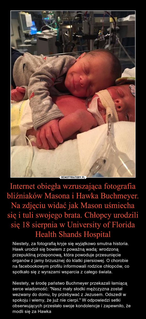 Internet obiegła wzruszająca fotografia bliźniaków Masona i Hawka Buchmeyer. Na zdjęciu widać jak Mason uśmiecha się i tuli swojego brata. Chłopcy urodzili się 18 sierpnia w University of Florida Health Shands Hospital