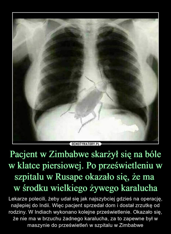 Pacjent w Zimbabwe skarżył się na bóle w klatce piersiowej. Po prześwietleniu w szpitalu w Rusape okazało się, że ma 
w środku wielkiego żywego karalucha