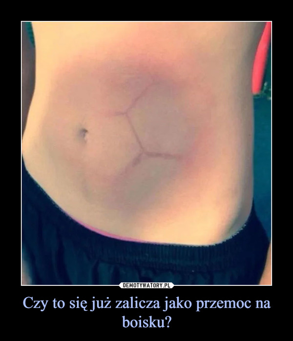 Czy to się już zalicza jako przemoc na boisku? –  