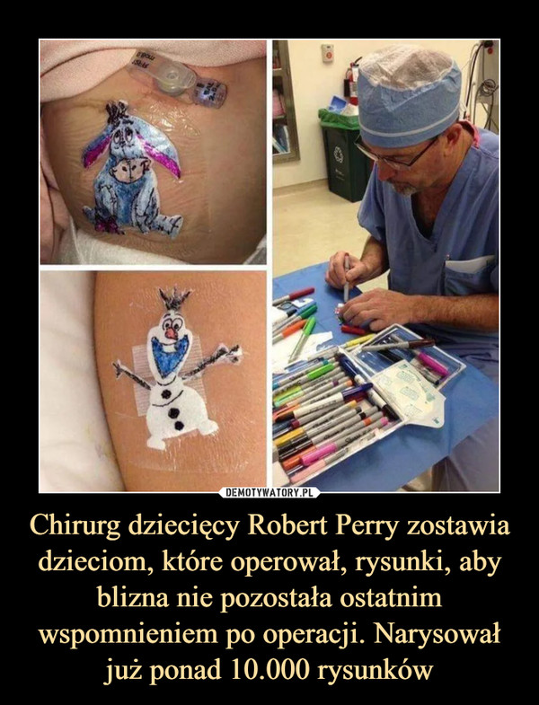 Chirurg dziecięcy Robert Perry zostawia dzieciom, które operował, rysunki, aby blizna nie pozostała ostatnim wspomnieniem po operacji. Narysował już ponad 10.000 rysunków