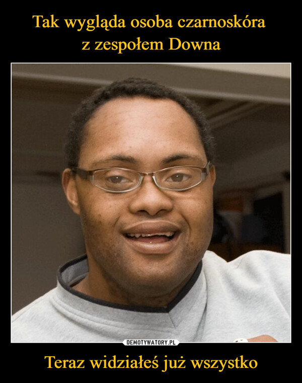 Tak wygląda osoba czarnoskóra 
z zespołem Downa Teraz widziałeś już wszystko