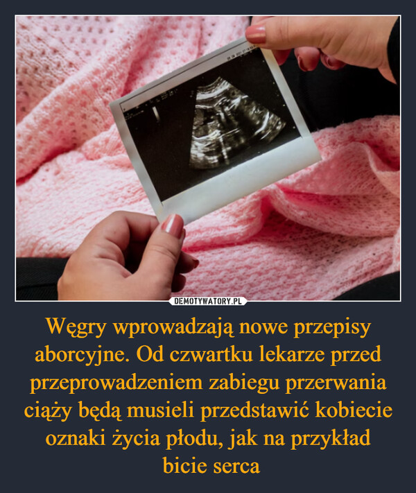 Węgry wprowadzają nowe przepisy aborcyjne. Od czwartku lekarze przed przeprowadzeniem zabiegu przerwania ciąży będą musieli przedstawić kobiecie oznaki życia płodu, jak na przykład bicie serca –  
